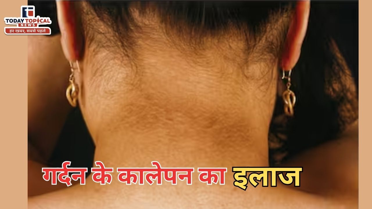 Gardan Par Kalapan: गर्दन का कालापन सिर्फ गंदगी की वजह से होता है