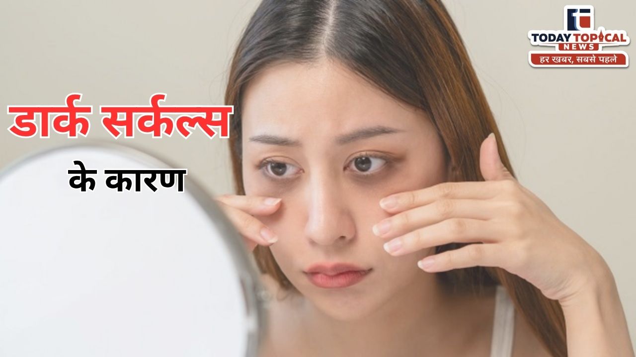 डार्क सर्कल्स की वजह